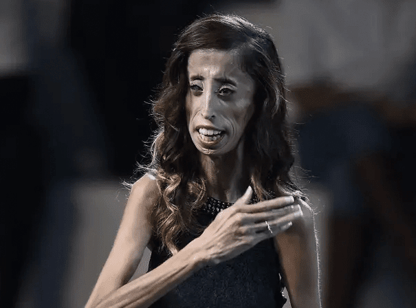 Lizzie Velasquez