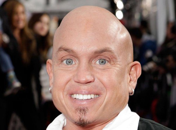 Martin Klebba